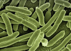 Normal_e.coli